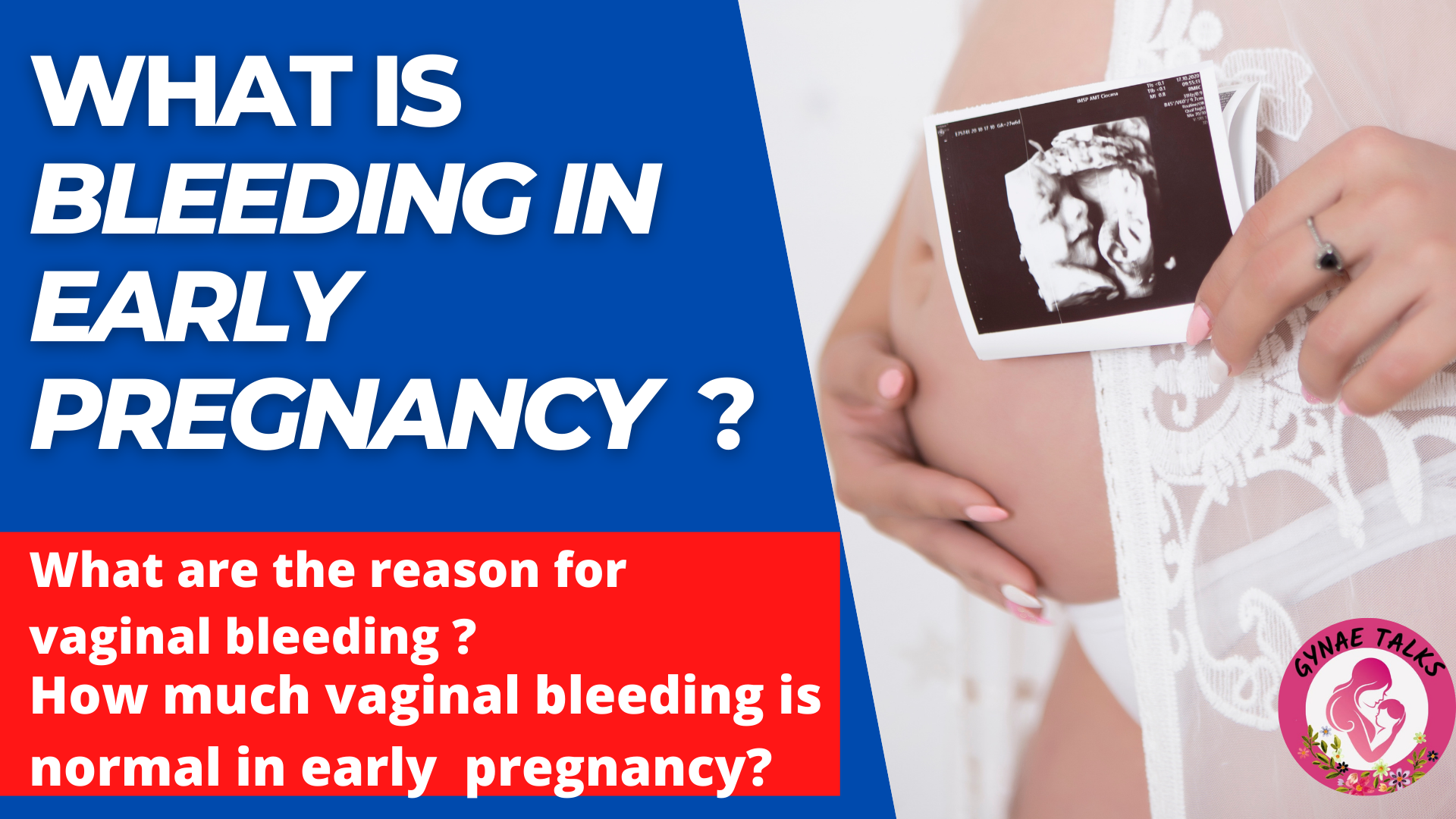 How much vaginal bleeding is normal in early pregnancy?